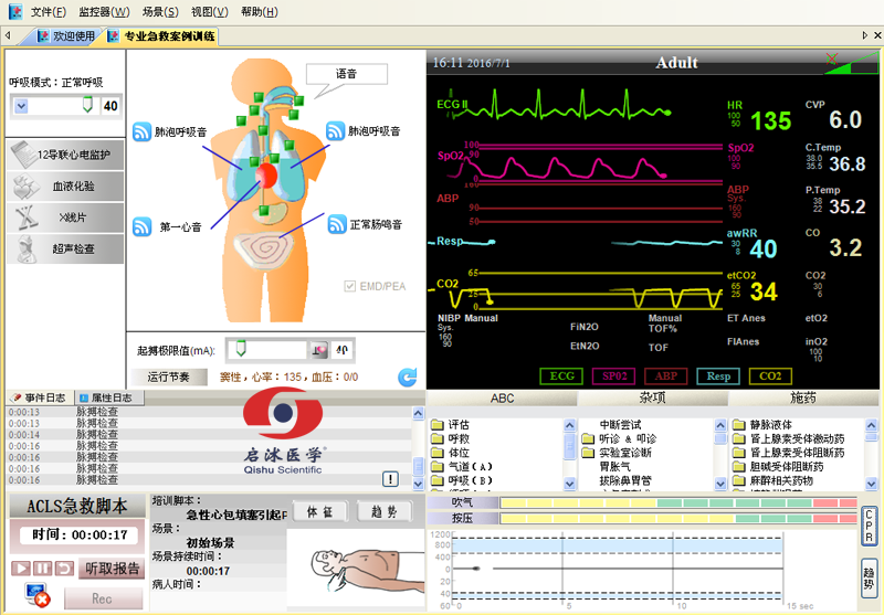  高智能數(shù)字化綜合急救技能訓(xùn)練系統(tǒng)（ACLS高級(jí)生命支持、計(jì)算機(jī)軟件控制）
